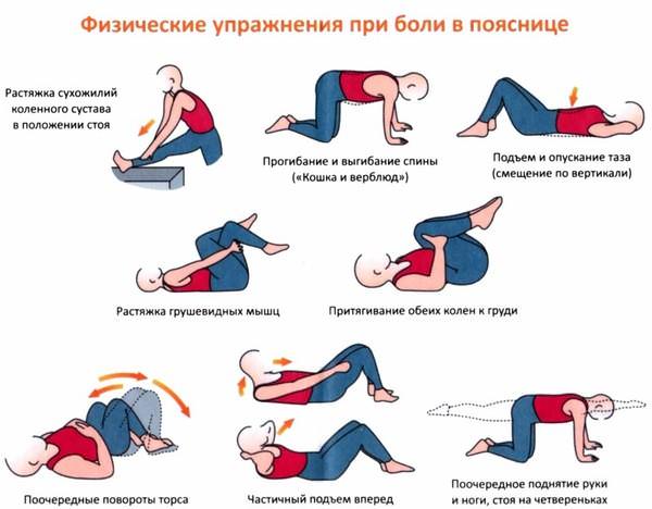 упражнения от боли в спине